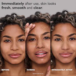 Peter Thomas Roth FIRMx™ Exfoliating Peel Gel