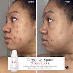 SK-II GenOptics Spot Essence Serum