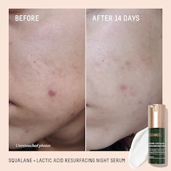 Biossance Squalane + 10% Lactic Acid Resurfacing Night Serum