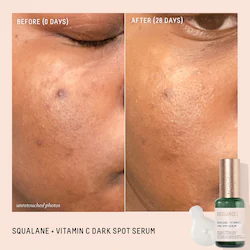 Biossance Squalane + 10% Vitamin C Dark Spot Serum