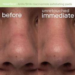 Skinfix Resurface+ AHA/BHA Niacinamide Exfoliating Pads for Face and Targeted Body