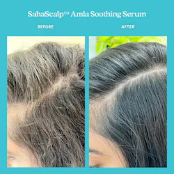 Fable & Mane SahaScalp&trade; Amla Soothing Serum