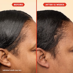 Fable & Mane Mini HoliRoots™ Pre-wash Hair Treatment Oil