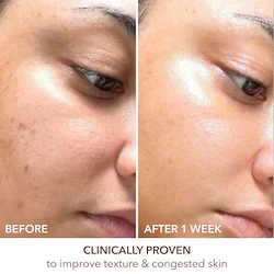 Dr. Dennis Gross Skincare Advanced Retinol + Ferulic Texture Renewal Serum