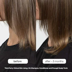 BondiBoost HG Shampoo for Thinning Hair