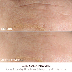 Dr. Dennis Gross Skincare Advanced Retinol + Ferulic Intense Wrinkle Cream
