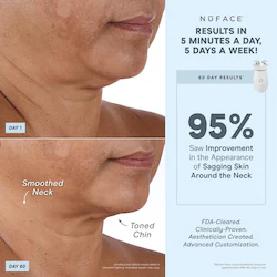NuFACE NUFACE® Trinity+ LED Red Light Wrinkle Reducer Attachment