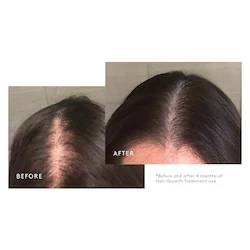 Virtue Flourish&reg; Nightly Intensive Hair Growth Treatment