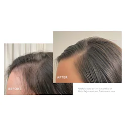 Virtue Flourish&reg; Nightly Intensive Hair Rejuvenation Treatment