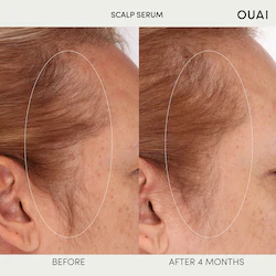 OUAI Hydrating Scalp Serum for Healthy, Fuller Looking Hair