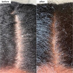 Briogeo Scalp Revival™ Dandruff Relief Charcoal Shampoo