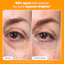 Paula's Choice C5 Super Boost Vitamin C Eye Cream for Brightening & Firming