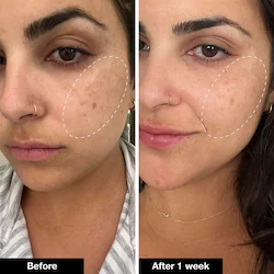 iNNBEAUTY PROJECT RETINOL REMIX 1% RETINOL TREATMENT
With Peptide & Tranexamic Acid