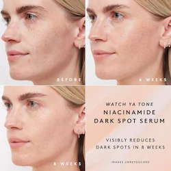 Fenty Beauty by Rihanna Watch Ya Tone 5% Niacinamide Dark Spot Serum with Vitamin C