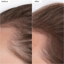 Briogeo Destined for Density™ Peptide Hair Serum for Thicker, Fuller Hair
