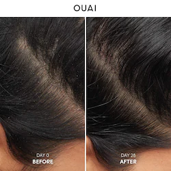 OUAI Anti-Dandruff Shampoo
