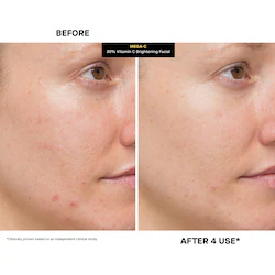 Kate Somerville MEGA-C™ 30% Vitamin C Brightening Mask