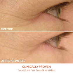 Dr. Dennis Gross Skincare DRx SpectraLite™ LED EyeCare Max Pro
