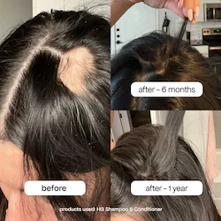 BondiBoost HG Shampoo & Conditioner Set for Thinning Hair with Rosemary