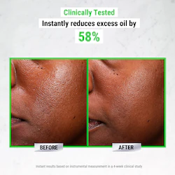 Kiehl's Since 1851 Ultra Pure High-Potency 5.0% Niacinamide Serum