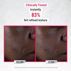 Kiehl's Since 1851 Ultra Pure High-Potency 9.8% Glycolic Acid Serum