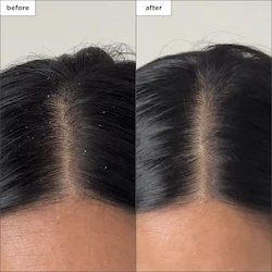 Briogeo Scalp Revival™ Charcoal + Tea Tree Buildup Detox Spray