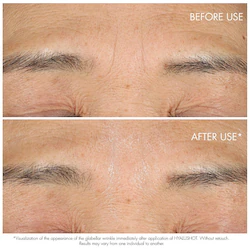 DIOR Capture Totale Hyalushot: Wrinkle Corrector with Hyaluronic Acid