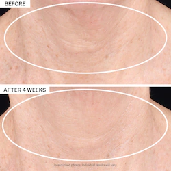 StriVectin TL Advanced™  Tightening Neck Cream Light