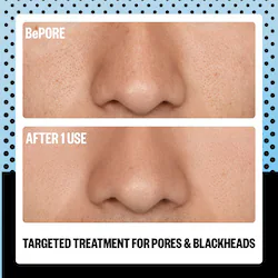 Peace Out AHA Pore & Blackhead Exfoliator Multitasking Treatment Stick