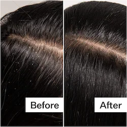 Act+Acre Cold Processed Scalp Detox Oil For Dry Scalp