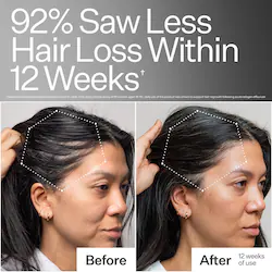 Act+Acre 3% Stem Cell Peptide Hair + Scalp Treatment For Severe Hair Thinning