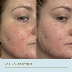 Biossance Ectoin Overnight Rescue Deep Repair Night Moisturizer + Squalane