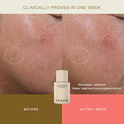 EADEM Cashmere Peel Milky Exfoliant & Hydrating Essence — Daily AHA + PHA Formula with 9% Azelaic, Lactic