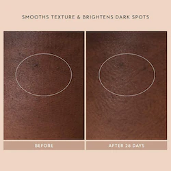 Shani Darden Skin Care Body Reform Treatment Serum with 2% Granactive Retinoid