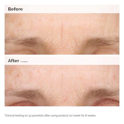 The Ordinary Retinal 0.2% Emulsion High-Strength Retinoid Nighttime Treatment