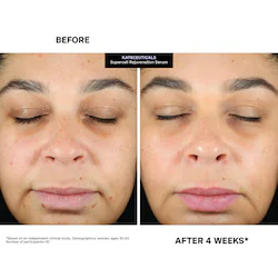 Kate Somerville KateCeuticals® SuperCell Rejuvenation Peptide Serum