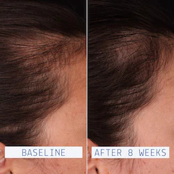 AAVRANI Hair Density Boosting Scalp Serum for Thinning Hair & Hair Loss