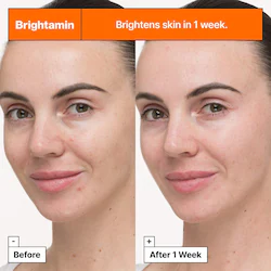 Dr. Jart+ Brightamin Brightening Serum with Niacinamide and Vitamin C