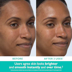 Peter Thomas Roth | Seph Even Smoother™ Facial Peel Exfoliator with Glycolic Acid for Brightening