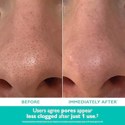 Pet Even Smoother™ Microdermabrasion Exfoliating Pore Purifier with Salicylic Acid for Oil Control