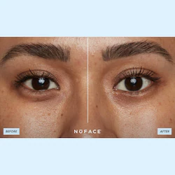 NuFACE NuFACE IonPlex® Hydra-Gel Power Patches