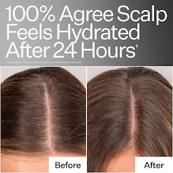 Act+Acre Daily Hydro™ Scalp Serum with Hyaluronic Acid for Dry Scalp