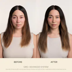 Vegamour | Sephor GRO+ Advanced Balancing Shampoo and Conditioner Set for Severe Signs of Thinning