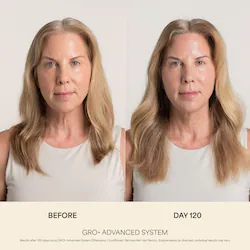 Vegamour GRO+ Advanced Balancing Shampoo for Severe Signs of Thinning