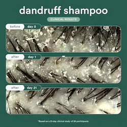 Verb Dandruff Shampoo with Salicylic Acid