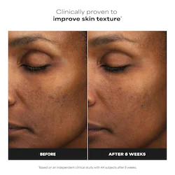 Paula's Choice Mini Skin Perfecting 6% Mandelic Acid + 2% Lactic Acid Liquid Exfoliant