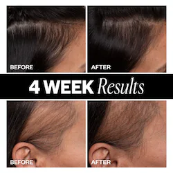 IGK Sponsored Hair Density Scalp Treatment for Thinning Hair