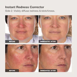 INNBEAUTY PROJECT Calm the Red Down Dual Chamber Redness Treatment Serum
