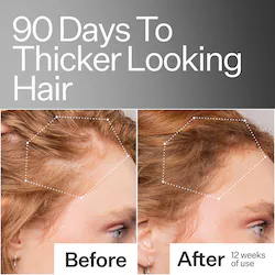 Act+Acre 2% Stem Cell H-2 Grow Complex ™ Scalp Serum For Thicker-Looking Hair