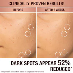 Charlotte Tilbury Dark Spot Correcting Radiance Recovery Serum